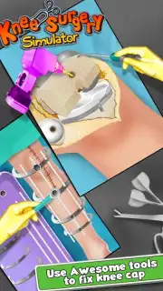 KneeSurgery скриншот 1