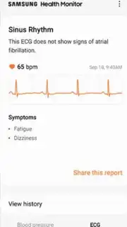 Samsung Health Monitor скриншот 1