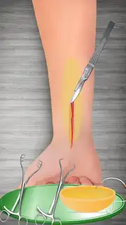 WristSurgeryDoctor скриншот 16
